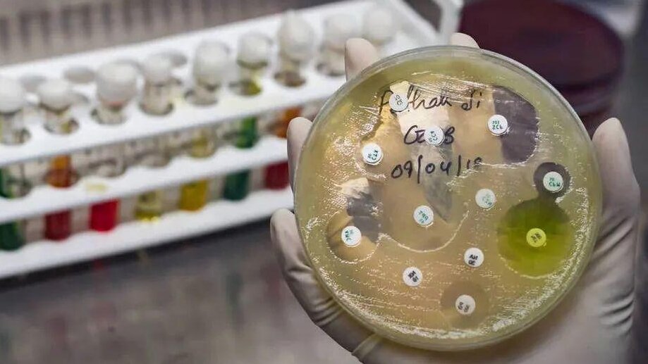 count bacterial colonies