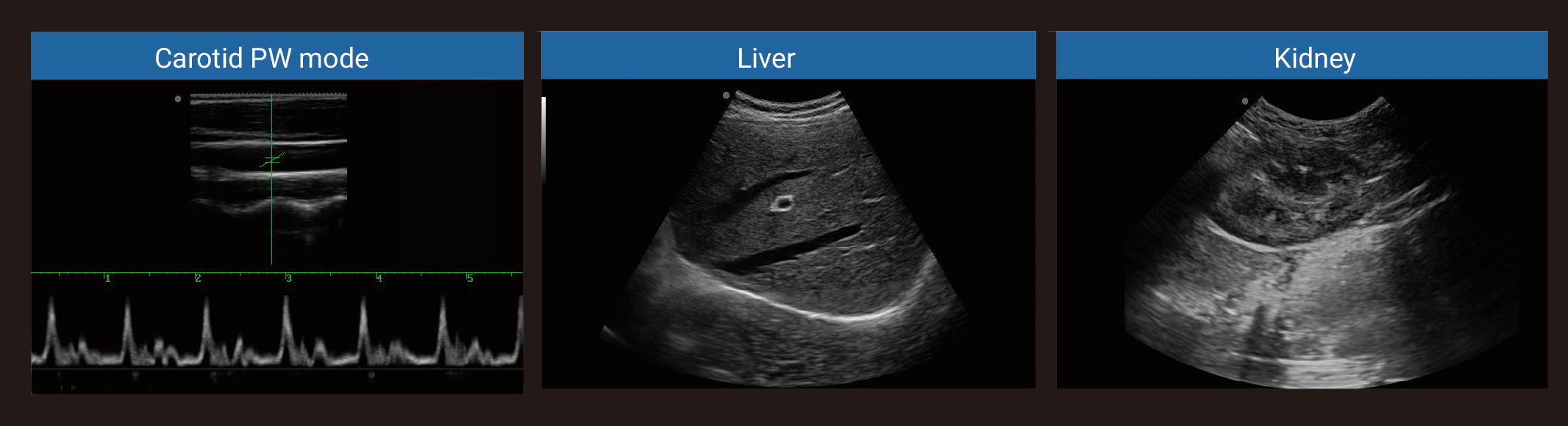 Ultrasound Machine 370b-1