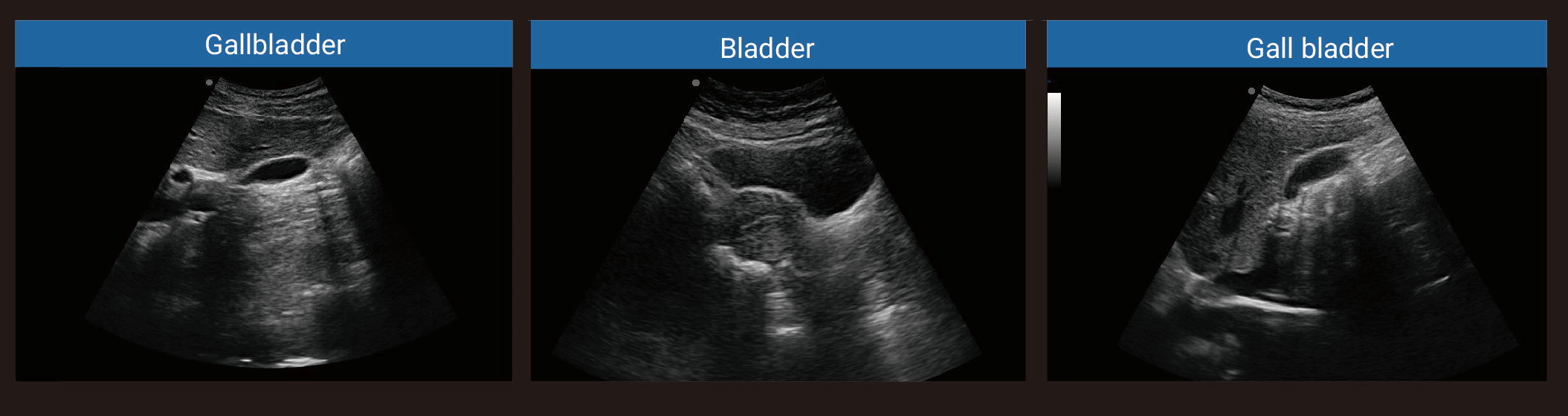 Ultrasound Machine 370b