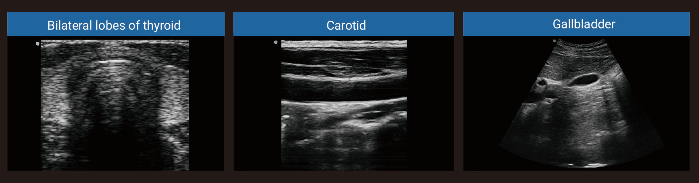Portable Ultrasound Machine