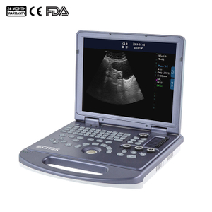 Portable Full-digital Black and White Ultrasound Machine