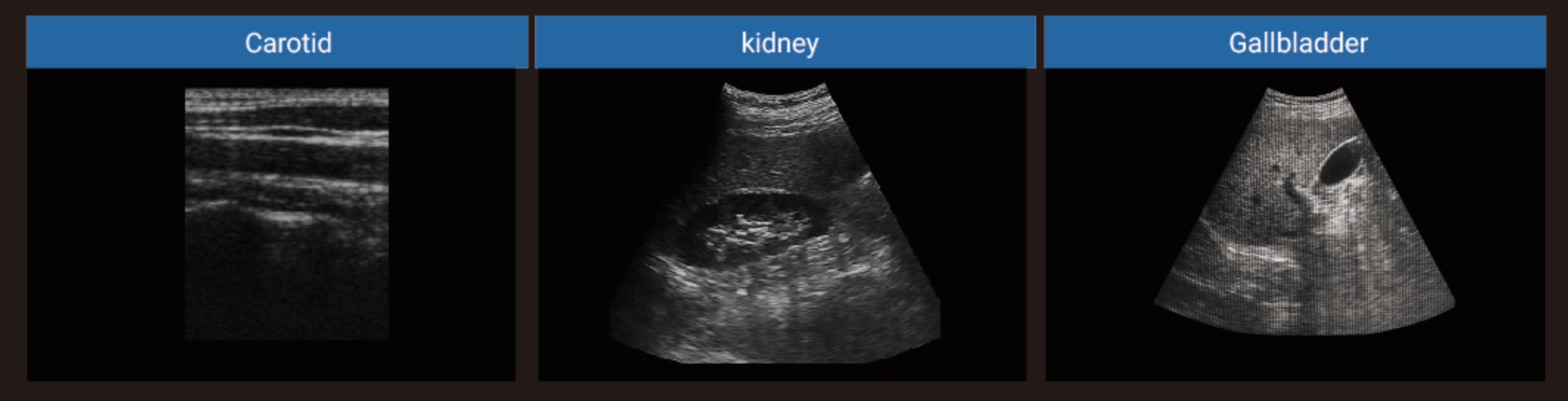 ultrasound machine 370