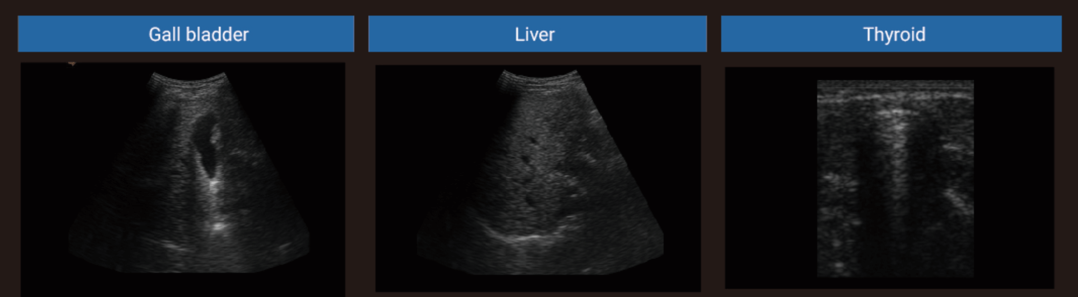 Ultrasound Machine 690