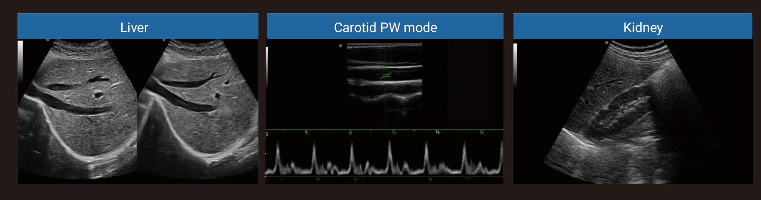 Portable Ultrasound Machine-1