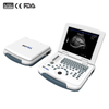 Portable Full-digital Black and White Ultrasound Scanner