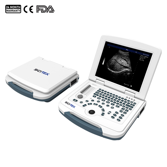 Portable Full-digital Black and White Ultrasound Scanner