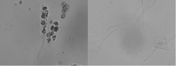 Urinalysis Hybrid Analyzer Results-1